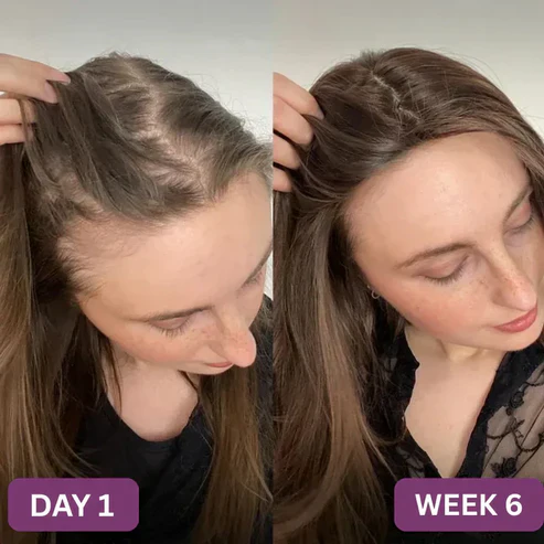 Hair Growth Gummies for Naturally Thicker, Stronger Hair - Image 6